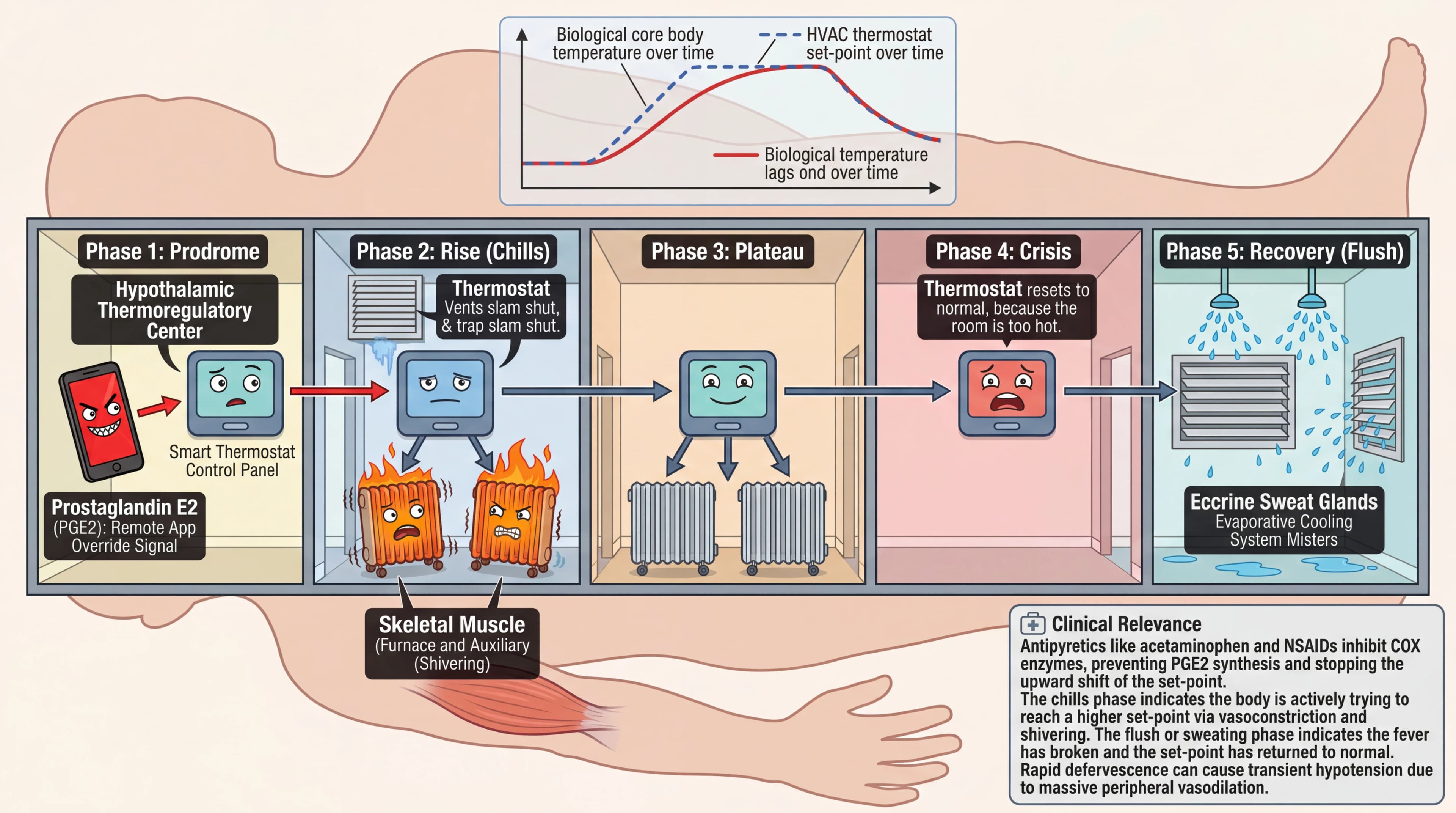 Visual mnemonic for Fever Response Pattern (Prodrome Rise Plateau Crisis Recovery) using HVAC / Smart Home Thermostat analogy